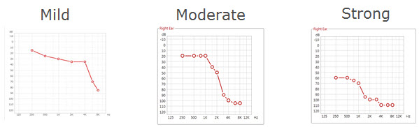 Examples of audiograms for each of the three Sound Shaper profiles