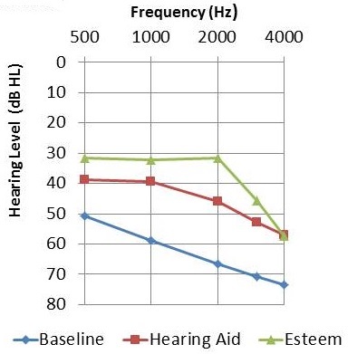 Mean audiometric thresholds for baseline unaided, hearing aid functional gain, and Esteem functional gain
