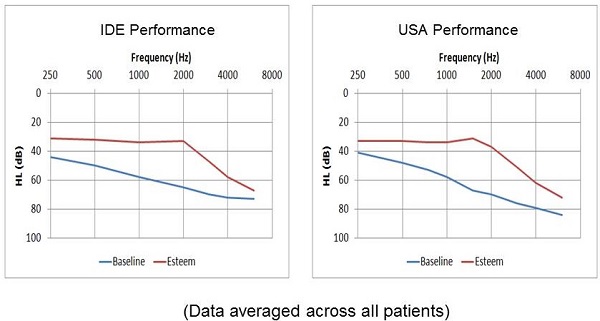 Comparison of audiometric results between subjects in the IDE clinical trial and post-approval commercial patients