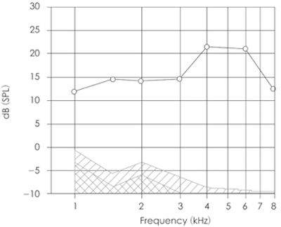 An example of a DP-gram