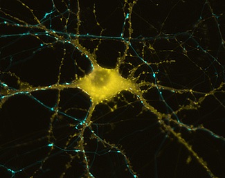 Human neuron showing actin formation in response to stimulation
