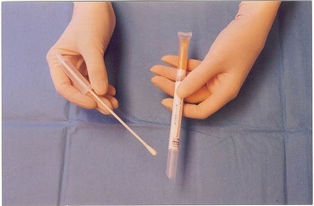 Specimen collection swabs and collection procedure