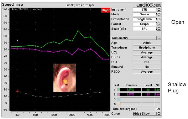 Real-ear measurements made with an open ear and a non-custom foam earplug with shallow insertion