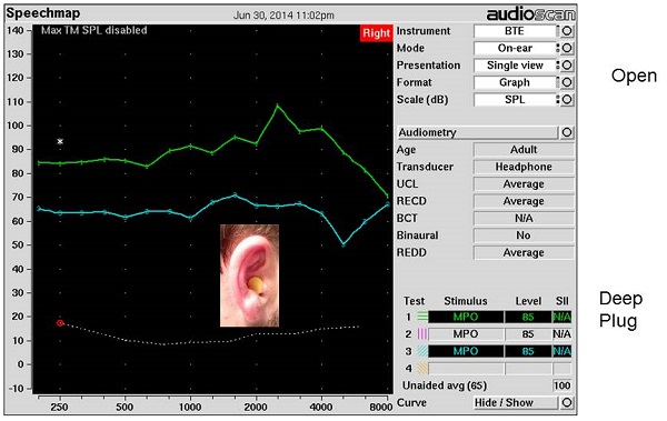 Real-ear measurements made with an open ear and a non-custom earplug with full insertion