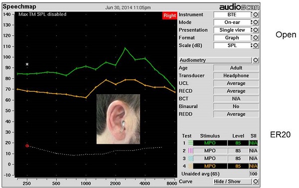Real-ear measurements made with an open ear and a non-custom, filtered ER20 earplug