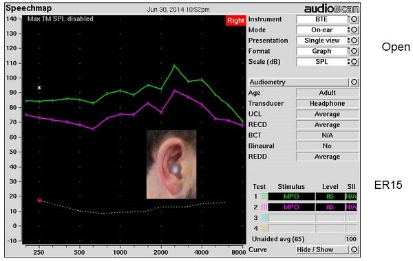 Real-ear measurements made with an open ear and a custom ER15 earplug