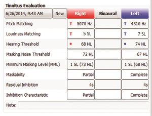 Tinnitus evaluation