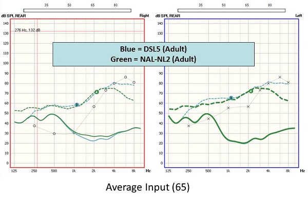 Comparison of NAL-NL2 and DSL 5 targets for a sloping, high frequency hearing loss, using a 65 dB input