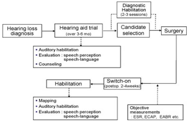 Cochlear implant process