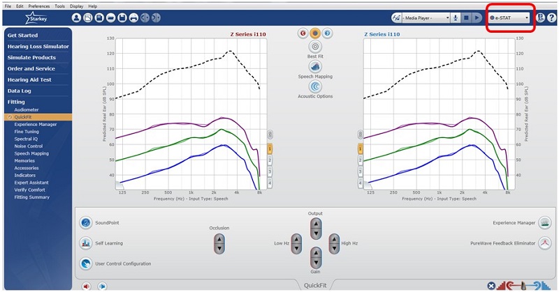 Inspire screen shot, indicting the default proprietary fitting formula, e-STAT