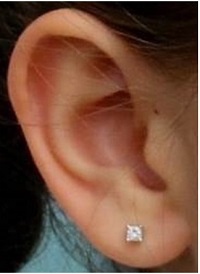 An example of a normal ear