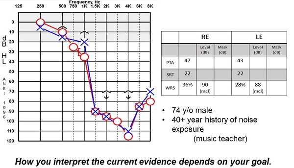 Example of a patient with precipitously sloping hearing loss who would seem to benefit from frequency shifting