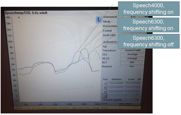 Speech mapping from the Verifit
