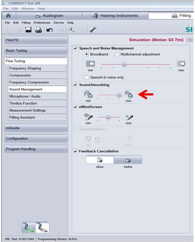 Siemens fitting screen where transient noise reduction can be adjusted