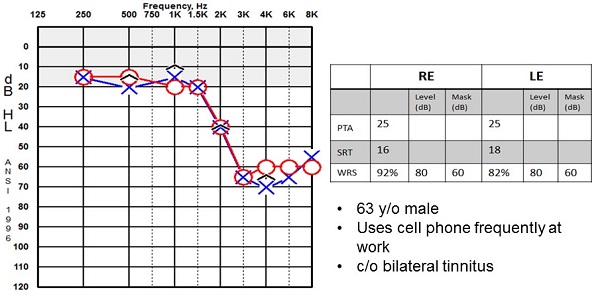 Example of a patient with a high-frequency sensorineural hearing loss that might benefit from automatic adaptation