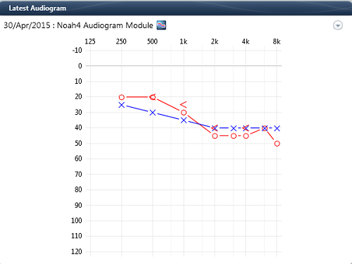 Example of Latest Audiogram in the audiogram module