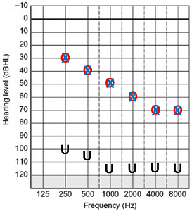 Basic Speechmap screen in Verifit 2