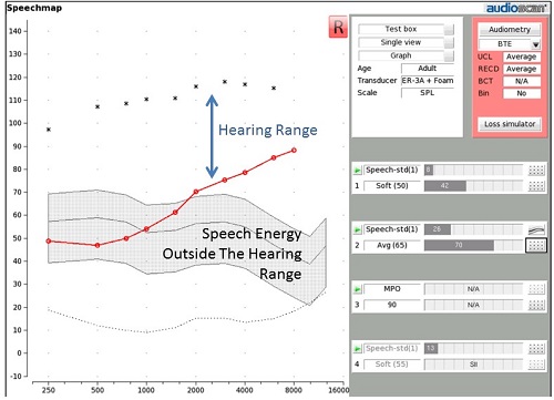 Speechmap where some speech energy falls outside of the hearing range