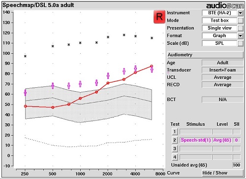 Speechmap of DSL 5.0 Adult targets for an adult aged patient