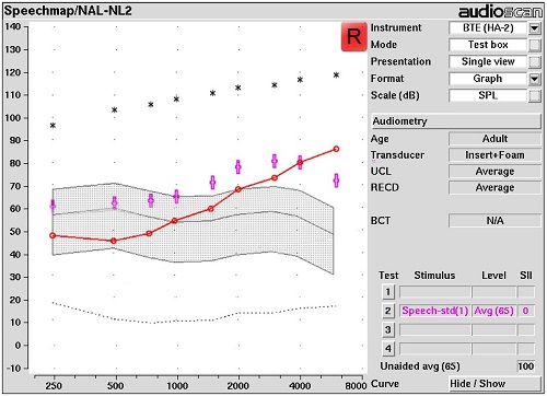 Speechmap of NAL-NL2 targets for an adult aged patient