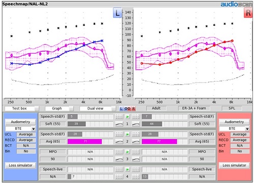 Initial aided audibility result for NAL-NL2 targets