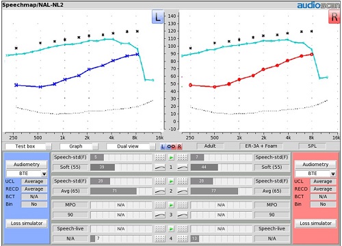 Fitting Test 3. MPO