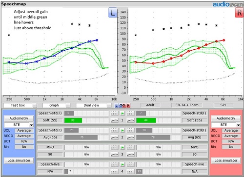 Soft speech fitting with no prescriptive targets selected