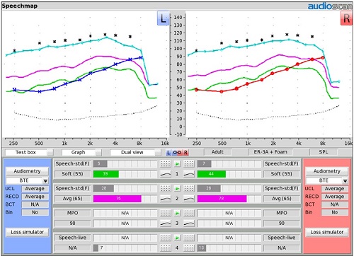 Final fitting summary with no prescriptive targets selected