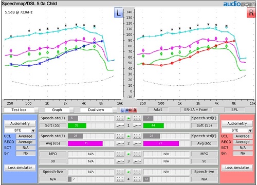 Final audibility with DSL Child with Adult Age targets added