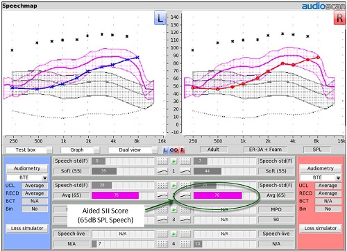 Speech Intelligibility Index Chart