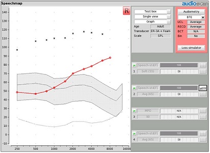 Basic Speechmap screen in Verifit 2