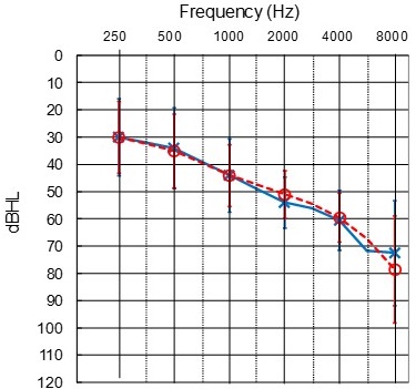 Average audiogram of study participants