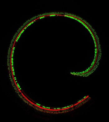 Sensory hair cells in the cochlea