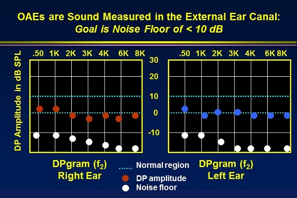 Corrected DPOAE recording