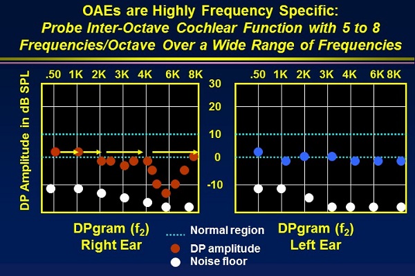 Including five to eight frequencies per octave will shows dips in the response due to cochlear abnormalities