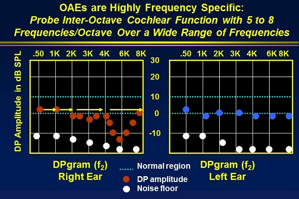 A diagram for plotting findings for tympanometry and acoustic