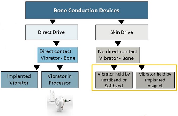 Direct Drive compared to Skin Drive systems