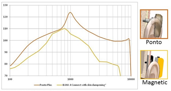 Does Using A Hearing Aid Weaken Your Real Hearing? - Clifton Springs Hearing  Center