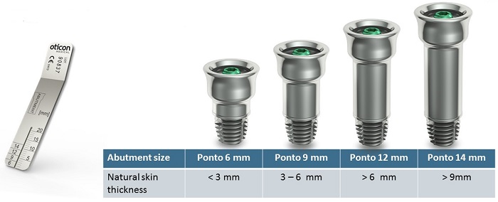 Ponto abutment family