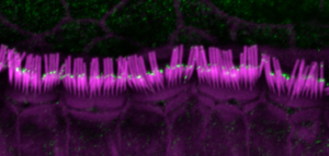 The larger form of myosin 15 is found in the shorter rows of mouse hair cell stereocilia