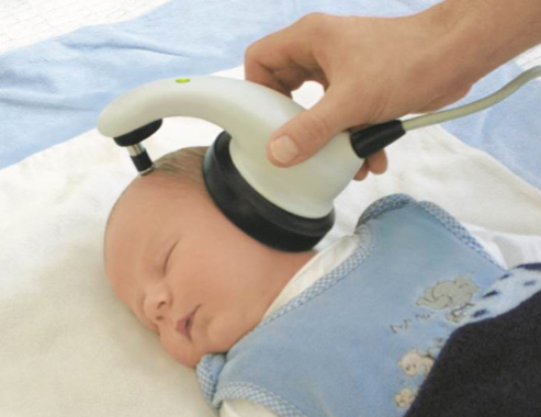 Macio MB-11 one-piece newborn hearing screener utilizing chirp stimuli