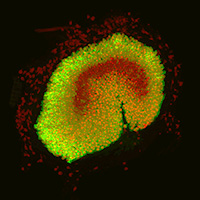 Hair cells and associated supporting cells in the sensory patch of a mouse utricle