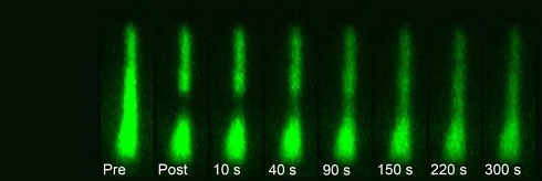 Each single hair bundle within the live zebrafish ear contains fascin 2b fused with green fluorescent protein