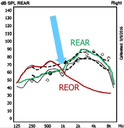 The REOR is the cause of the dip in the REAR