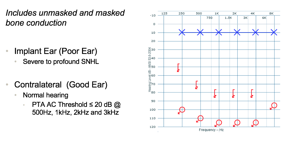 Audiometric testing