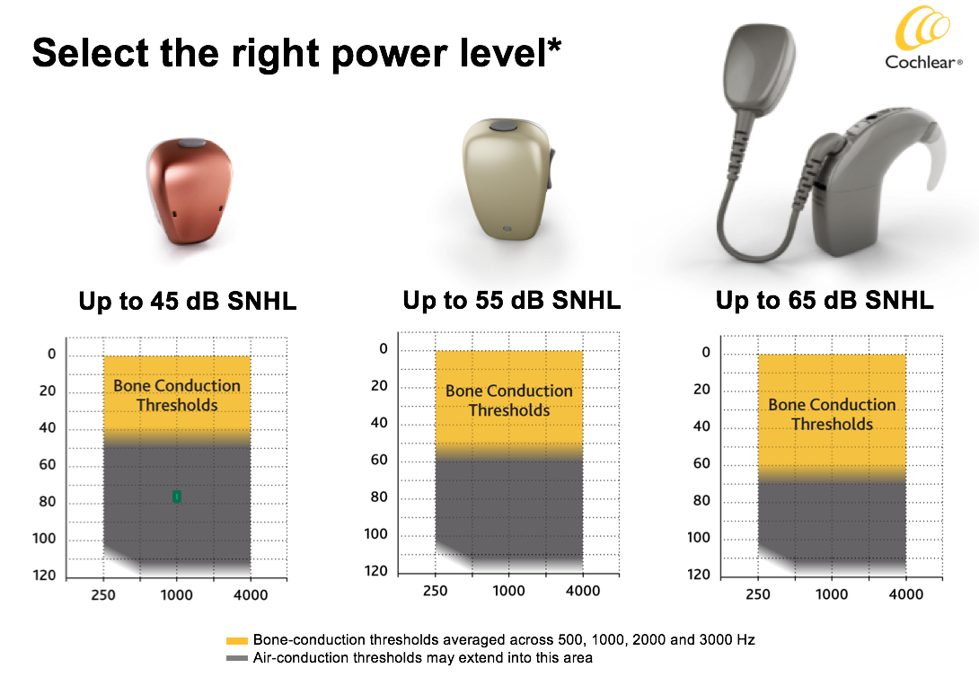 Baha System power levels