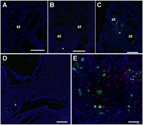 Ly49H blockade induces co-localization of mCMV-GFP infected cells and NK cells within the temporal bone
