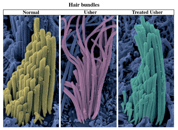 Hair bundles of vestibular sensory cells analyzed using scanning electron microscopy