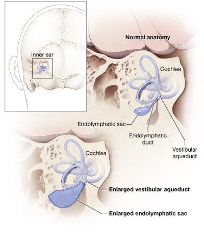 the anatomy of the inner ear