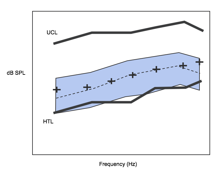 Speech map for moderate speech level input